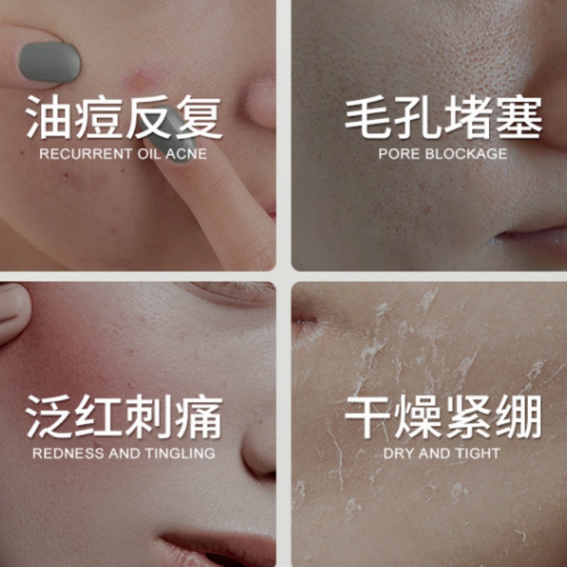 Centella Asiatica Salicylic Ac - огляд і ціна Salicylic Acid Blackhead Remover